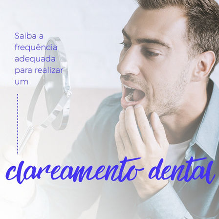 Clareamento Dental