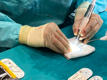 Bringing Advanced Technology to Rhinoplasty in Edinburgh: Introducing Piezoelectric Surgery