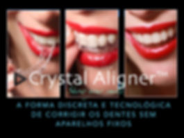 Crystal Aligner