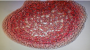 image of dry blood sample