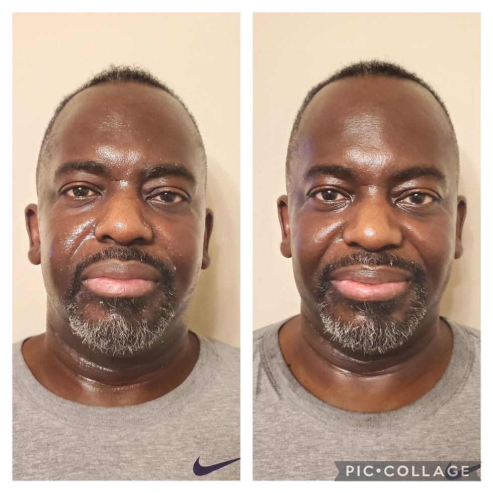 Sinus Facial