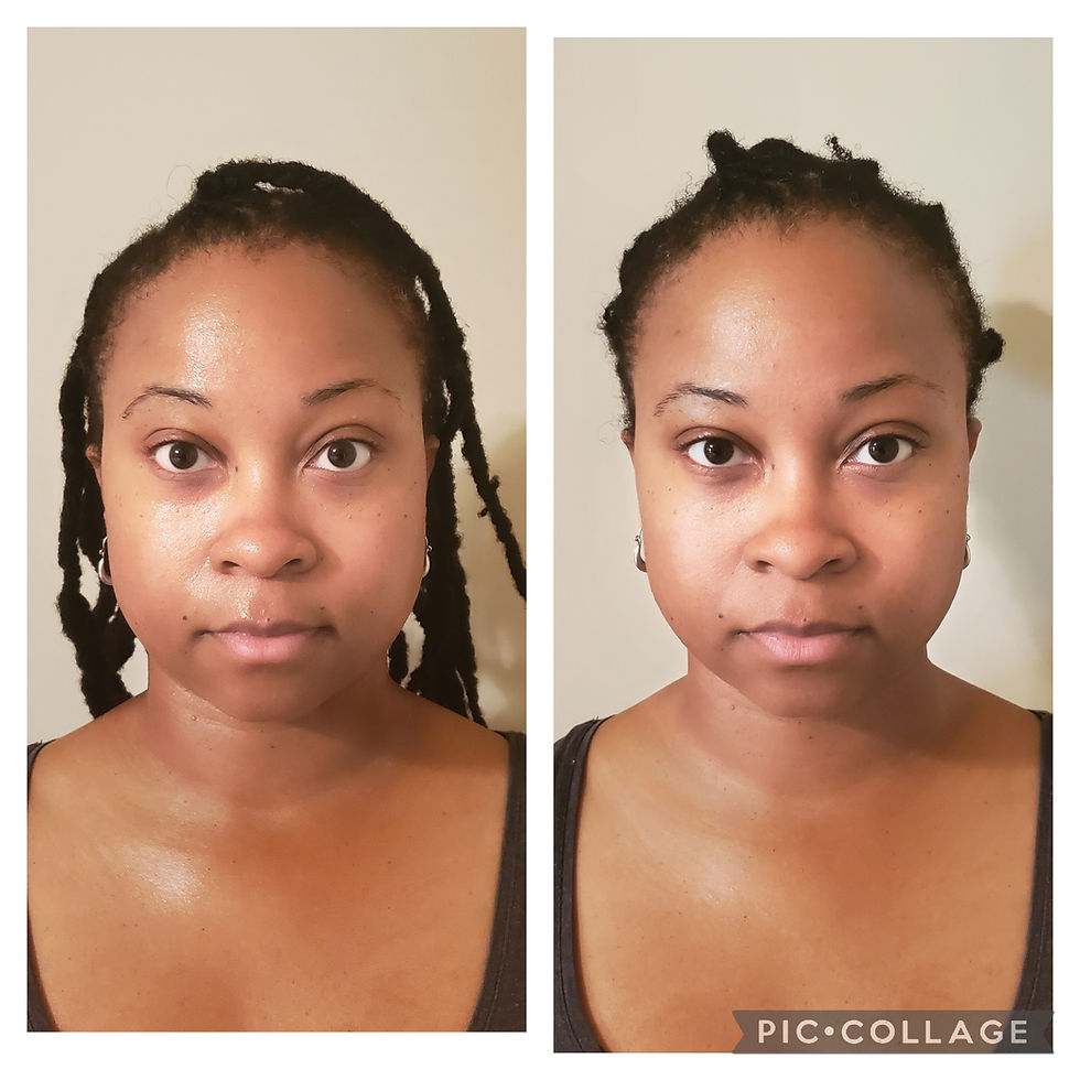 Sinus Facial