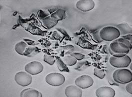 Live Blood Analysis