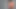 dor-cronica-blog.jpg