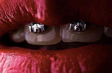 Ortodoncia con brackets y Ortodoncia invisible