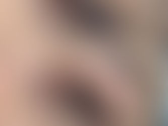 Are lash lifts suitable for short lashes?