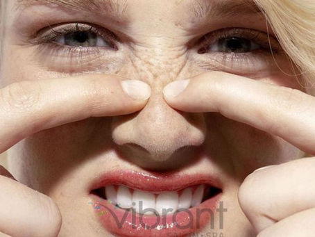 How can Botox Help in Reducing Bunny Lines?