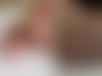 Is it Safe to Get Manicures and Pedicures with Sensitive Skin?