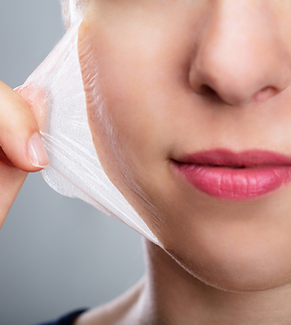 SkinTrust Chemical Peel (3).png