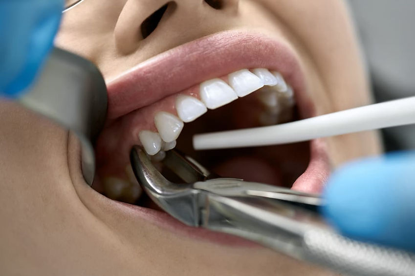 pulling teeth