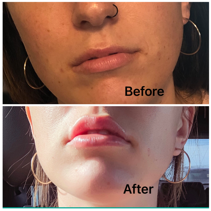 RESULTS ENVY CLINIC & SPA GALLERY OF BEFORE & AFTER