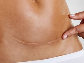 My Sweet Spot: Two Years of Healing