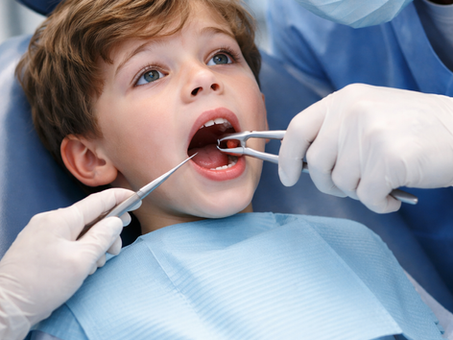 tooth extractions