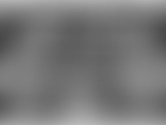 춘천 참좋은치과 임플란트 증례 10568