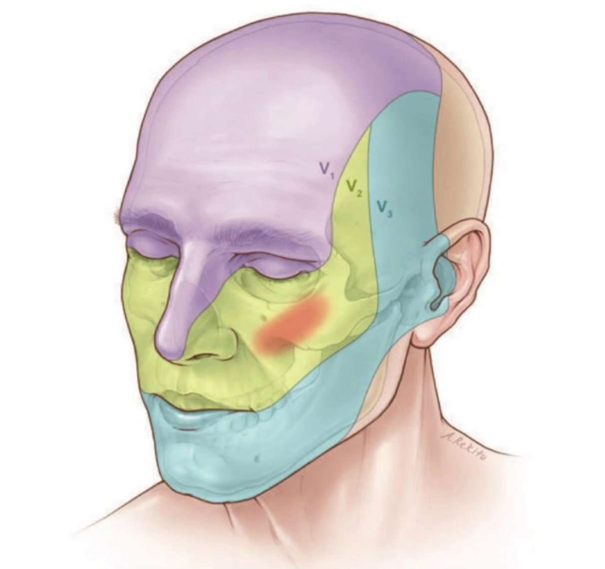 nevralgia trigeminal dr. eric grossi