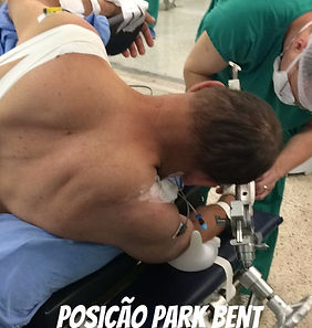 Posicionamento para neurocirurgia. Portador de neurinoma do acústico posição park-bent ou 3/4 prono