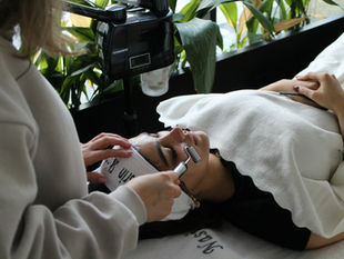 Chronic Facial Puffiness
