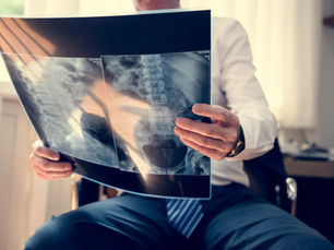 The High Cost of Delaying a Bone Density Scan: Bay Area Catch-Up Plan