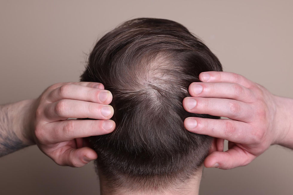 man with thinning hair