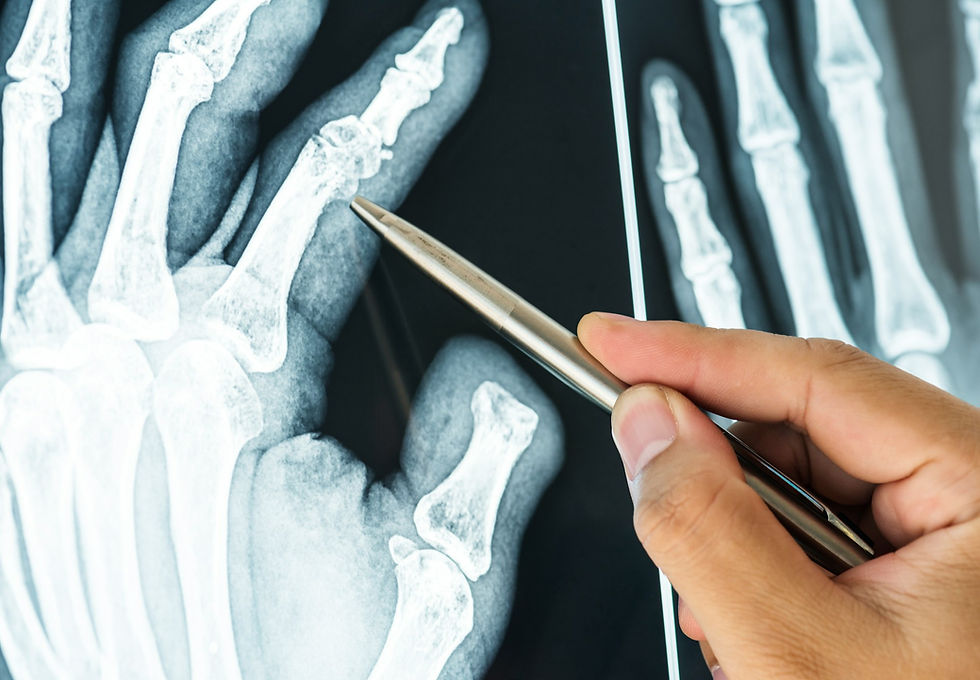 What Active Bay Area Men Need to Know About Bone Health Scans