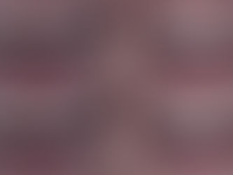 Facetas e Lentes de Contato em Resina Composta - A especialidade do Dr. Henrique Tabuse