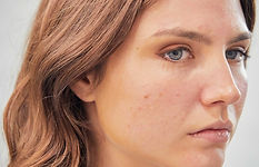 Image of the suggested treatment