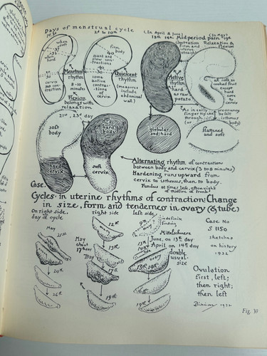 完訳・人体性解剖学図説 ATLAS OF HUMAN SEX ANATOMY Atlas of Human Sex Anatomy by Robert Latou Dickinson 1958