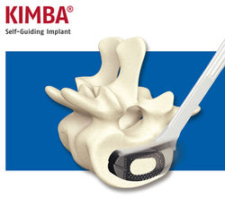 Kimba Self-Guiding Implant