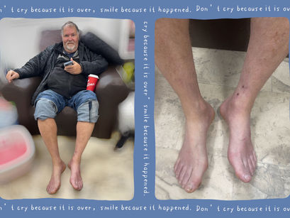 Diabetes foot care! #footcare #pedicure #callusremoval #cuticlecare