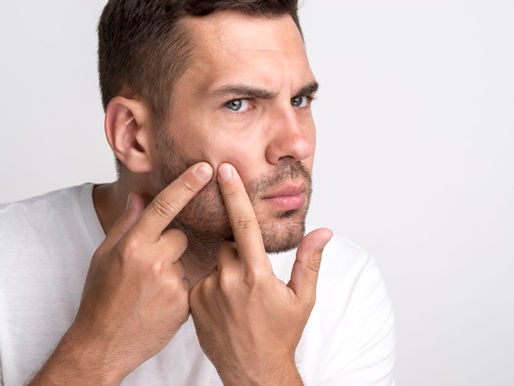 Pimples Are Not Caused By Dirt or Diet