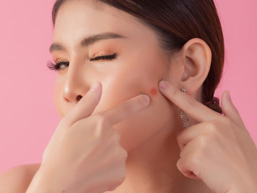 Acne Scar Treatment at Dr. Meet Clinic