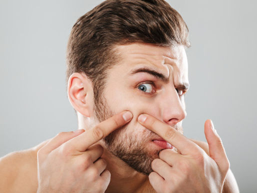 Summers: Acne Problems Knocking On The Door!