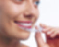 Adult_aligner006.jpg