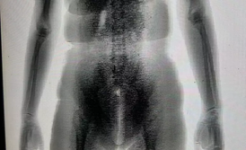 Mulher tenta entrar em presídio com cerca de 140 g de drogas nas partes íntimas na Bahia