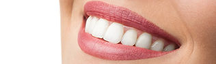 Invisalign Completion