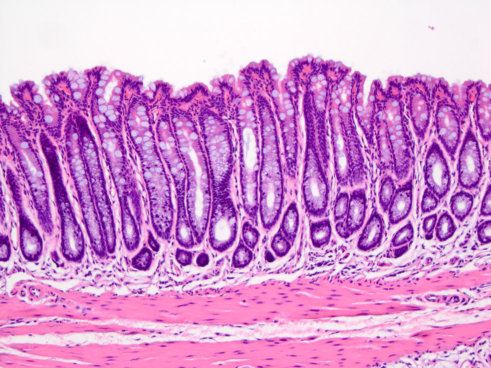 Colon Tissue – Dex-Loaded Hydrogel Treatment