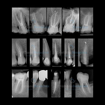 Endodonzia sito.001.jpeg