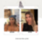 Chin Liposuction & Face Fat Graft