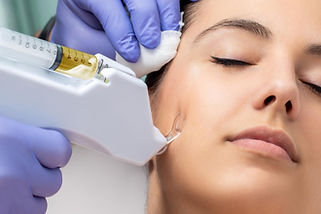 Mesotherapy-Facial.jpg