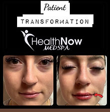 HealthNow Antes y Después