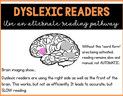 dyslexia 8.png