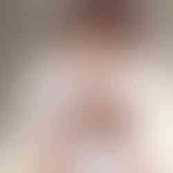 Photo restoration after