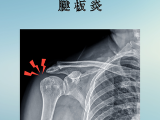 肩に激痛・・「石灰沈着性腱板炎」って?
