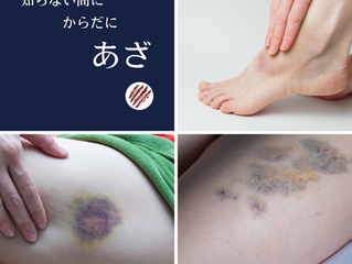 あざ、味がわからない、今どき脚気?!体からのサイン!見逃さないでね。