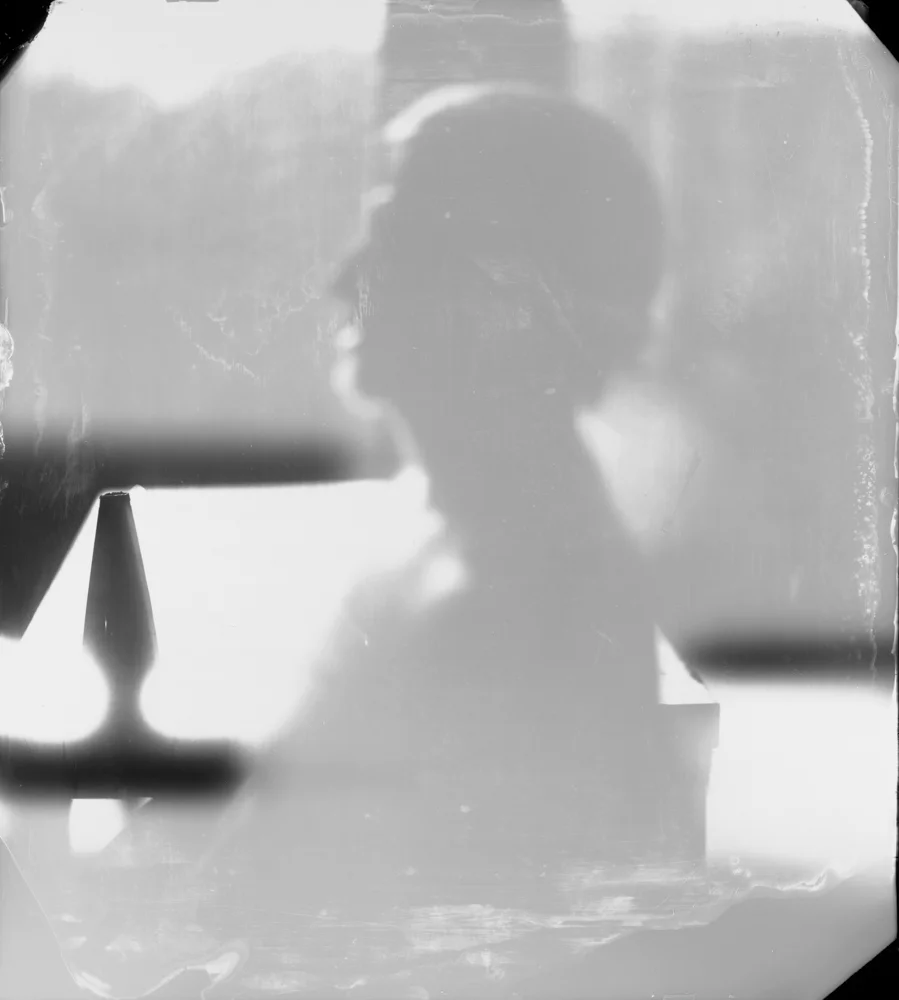 Damaged Child, 1984 Gelatin silver enlargement print 20 x 24 inches