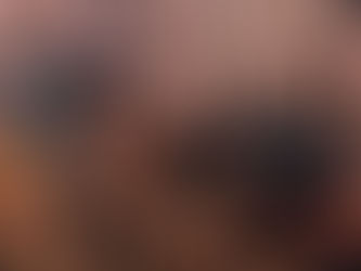 驚!有『這些習慣』將離洗腎不遠!