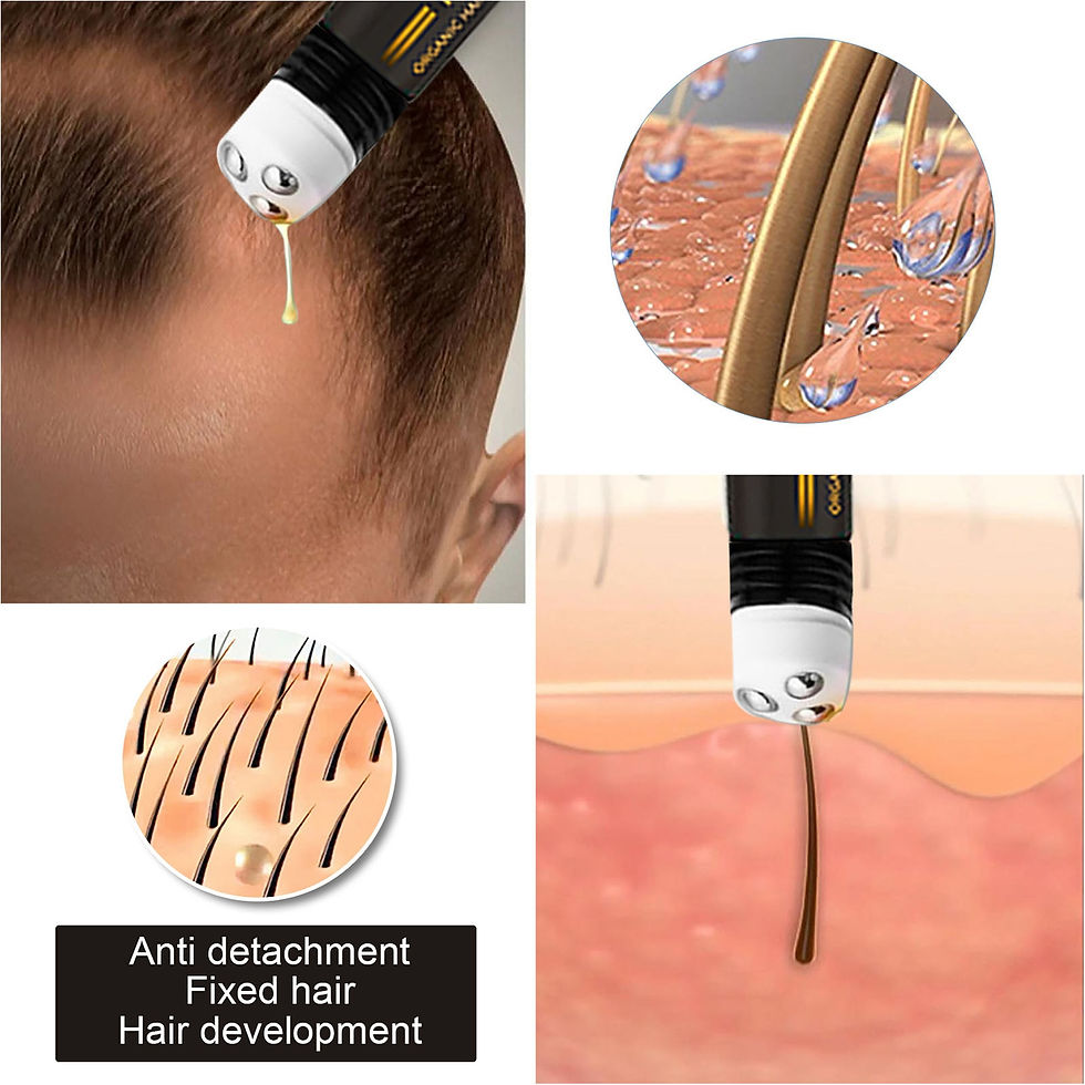 Thumbnail: Hair Growth Products Anti Hair Loss Essential Oil Head Massage Beauty Care