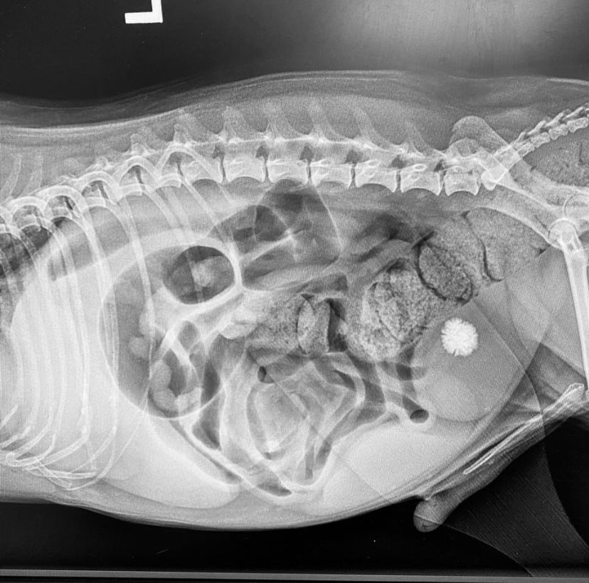 Bladder Stone Rad.jpeg