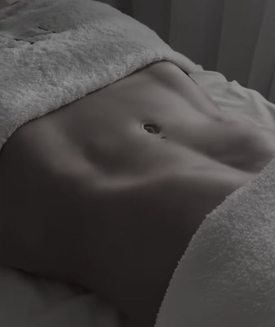 lipoaspiração e lipohd Dr. Frederico Marques