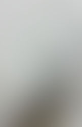 25年ぶりの自分の手術記録